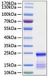 Recombinant Human GTPase KRas/KRAS Protein (RP01240)