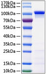 Active Recombinant Human Catenin beta-1 Protein (RP01241)