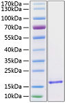 Recombinant Human/Mouse/Rat BDNF Protein (RP01243)
