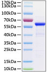 Recombinant Human TET2 Protein (RP01247LQ)