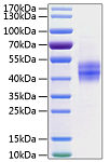 Recombinant Human Follistatin/FST/FST315 Protein (RP01249)