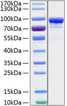 Recombinant Human STAT1 Protein