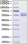 Recombinant Human IL-15 Protein (RP01257)