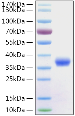Recombinant SARS-CoV-2 Spike RBD Protein