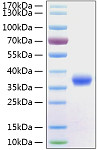 Recombinant SARS-CoV-2 Spike RBD  Protein (RP01258)