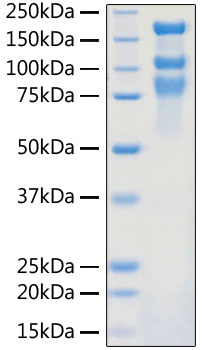 Recombinant SARS-COV-2 Spike S1+S2 ECD(S-ECD) Protein