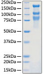 Recombinant SARS-COV-2 Spike S1+S2 ECD(S-ECD) Protein (RP01260LQ)