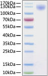 Recombinant SARS-CoV-2 Spike S1 Protein (RP01262)