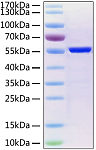 Recombinant SARS-CoV-2 Nucleocapsid Protein (RP01264LQ)