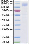 Recombinant SARS-CoV-2 Spike S1 Protein (RP01265)