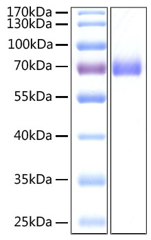 Recombinant SARS-CoV-2 Spike S2 ECD Protein was determined by SDS-PAGE with Coomassie Blue, showing a band at 70 kDa.