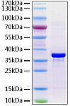 Recombinant Human FGL1/HP-041 Protein (RP01268LQ)