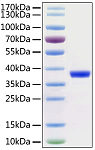 Recombinant SARS-CoV-2 3C-like Proteinase Protein (RP01270LQ)