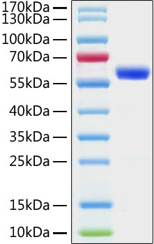 Recombinant SARS-CoV-2 Spike RBD Protein