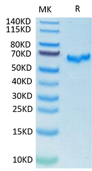 Recombinant SARS-CoV-2 Spike RBD Protein