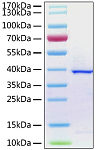Recombinant SARS-CoV-2 papain-like protease Protein (RP01274LQ)