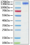 Recombinant Human ACE-2 Protein (RP01275)