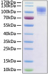 Recombinant Human ACE2 Protein with His tag (RP01276)