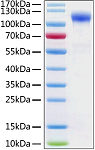 Active Recombinant Human ACE-2 Protein (RP01277)
