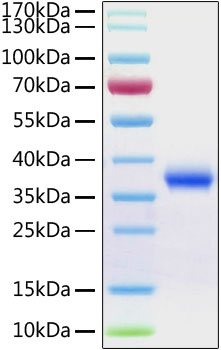 Recombinant SARS-CoV-2 Spike RBD Protein