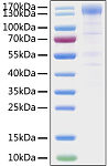 Recombinant SARS-CoV-2 Spike S1 Protein (RP01279)
