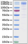 Recombinant SARS-CoV-2 Spike S1 Protein (RP01280)