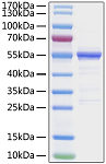 Recombinant SARS-CoV-2 Nucleocapsid(G335A) Protein (RP01281LQ)