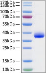 Recombinant SARS-CoV-2 Spike RBD  Protein (RP01282)