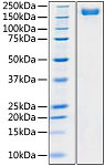 Recombinant SARS-CoV-2 Spike S1+S2 ECD(S-ECD) Protein (RP01283LQ)