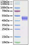 Recombinant Human IL-12B Protein (RP01288)