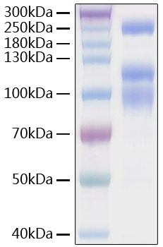 Recombinant SARS-CoV-2 Spike S1+S2 ECD(S-ECD)(D614G)  Protein