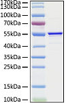 Recombinant SARS-CoV Nucleocapsid Protein (RP01296LQ)