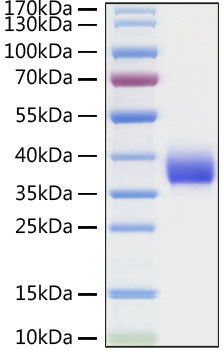 Recombinant SARS-CoV Spike RBD Protein