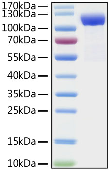 Recombinant Human DPP4/CD26  Protein