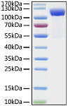 Recombinant Human DPP4/CD26  Protein (RP01300LQ)