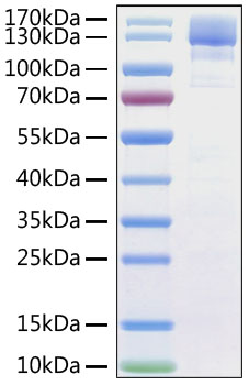 Recombinant SARS-CoV Spike S1 Protein