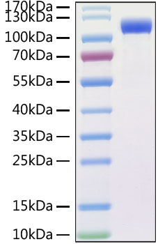 Recombinant SARS-CoV Spike RBD Protein