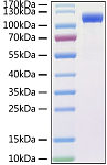 Recombinant SARS-CoV Spike RBD  Protein (RP01304)