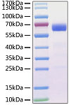 Recombinant MERS-CoV Spike RBD  Protein (RP01305)