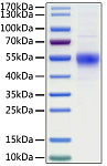 Recombinant Human CD19 Protein (RP01307)