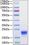 Recombinant Human IL-5 Protein (RP01316)