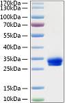 Recombinant Rat VEGF-A/VEGF164 Protein (RP01323)