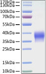 Recombinant Mouse B7-H5/Gi24/VISTA Protein (RP01328)
