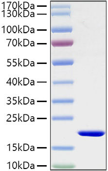 Active Recombinant Mouse IL-1 beta Protein