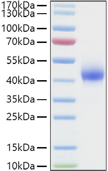 Recombinant Human Dkk-1 Protein