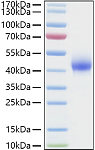 Recombinant Human Dkk-1 Protein (RP01343)
