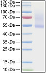 Recombinant Human Decorin/PG-S2/DCN Protein (RP01344)