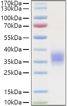 Recombinant Human TNFRSF1A/TNF-R1/CD120a Protein