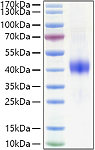 Recombinant Mouse Dkk-1 Protein (RP01350LQ)