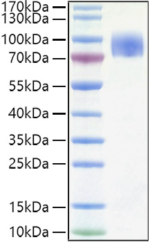 Recombinant Human CD200R1 Protein